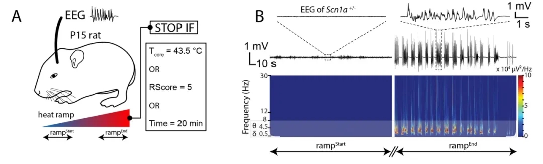 【技術文獻】NEPA21在腦神經疾病動物模型構建中的應用——嬰兒癲癇綜合征大鼠模型再現臨床特征