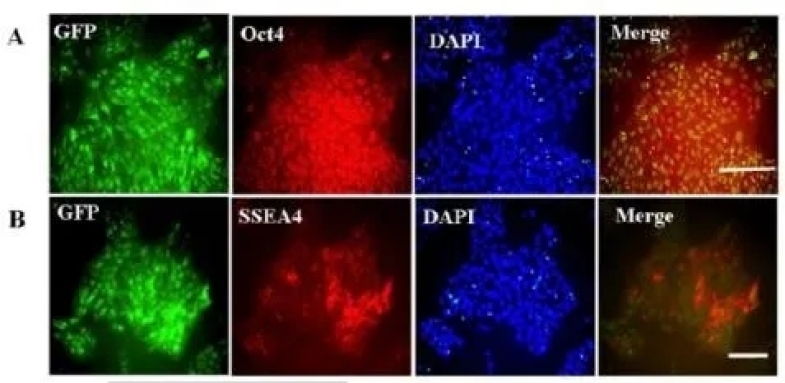 干細胞轉染及基因編輯，一篇講透！